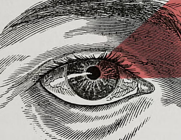 Black-and-white engraved illustration of a human eye, with a translucent red triangular overlay covering the upper-right area around the eyelid and eyebrow.